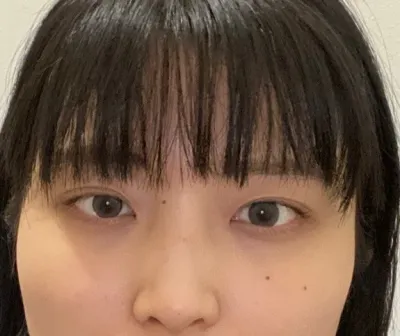 [鼻] ビョルイカビ - 目、鼻