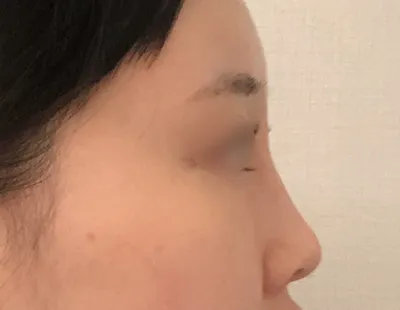 [目] チョクホケイク - 目、鼻