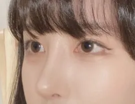 [目] ココモン - 鼻