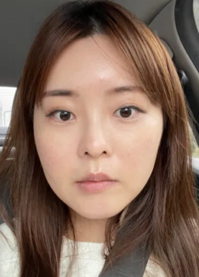 [輪郭手術] ドクターモイア - 目、輪郭、鼻、顔の脂肪吸引