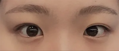 [目] ミンルルルルック - 目