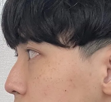 [鼻] ヒップヒンジ - 鼻