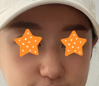 [鼻] はあああ - 鼻