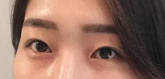 [目] それでも - 目