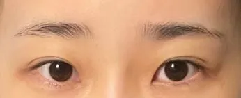 [目] ポカリスエット - 目