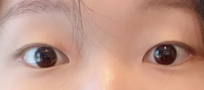 [目] コブギ - 目