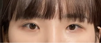 [目] デイリーアイ - 目