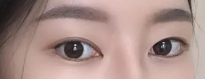 [目] レモナチョア - 目