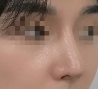 [鼻] 私はケリー - 鼻