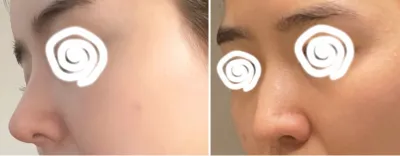 [鼻] ククダツ - 鼻