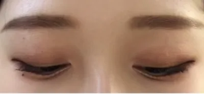 [目] 魚のフライ - 目