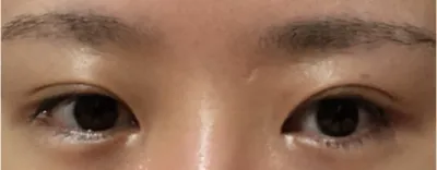 [目] チョン・セウ - 目