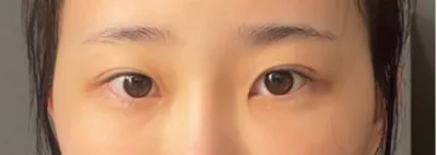 [目] 口コミで聞きました - 目