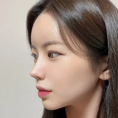 [鼻] ディオール - 鼻先、鼻筋、骨切り、わし鼻、曲がり鼻