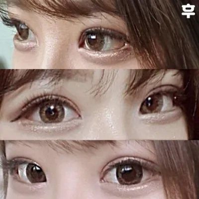 目の手術から3週間経ちました（笑）