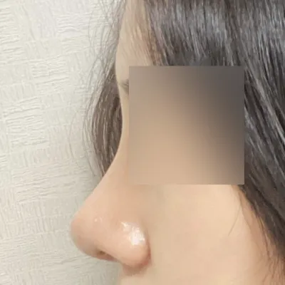 友達が手術したところなので信じてやりました（笑）