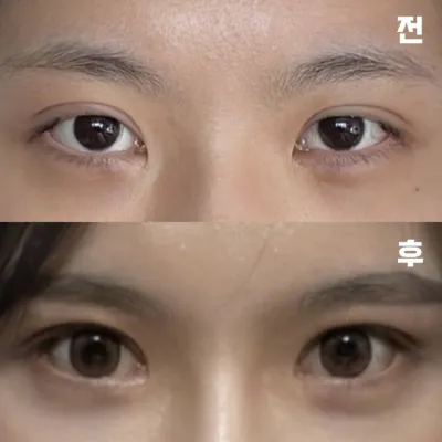 腫れが引いた姿がもう楽しみです