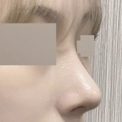 もう手術して2ヶ月になります!!