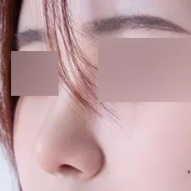 鼻の悩みがあるなら本当におすすめです～