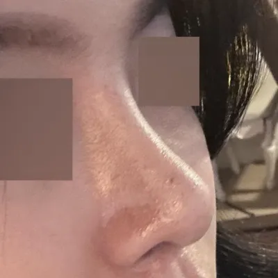 周りから鼻がきれいだと毎日のように言われています（笑）