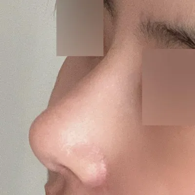 今はもう団子鼻とはお別れしたみたいです（笑）