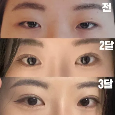 もう3ヶ月になりますが、本当に自然です