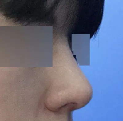 男は直線的な鼻だと言う理由が今になって理解できました（笑）