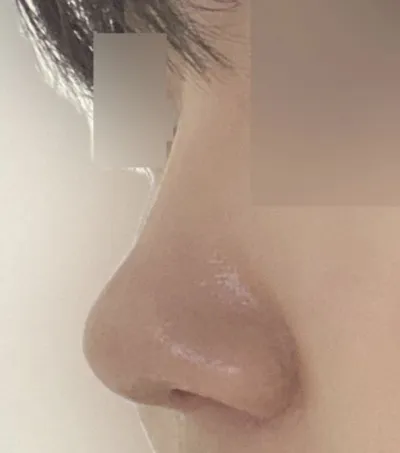 自然に仕上がって満足です