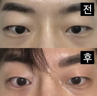 目だけでなく鼻も大成功でした