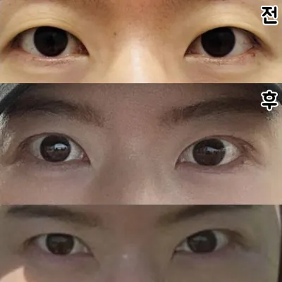 院長先生が上手に作ってくださったので、大満足です