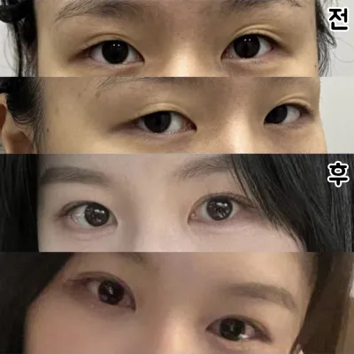 目に合わせてラインを決めてくださるので、より自然な仕上がりになったと思います