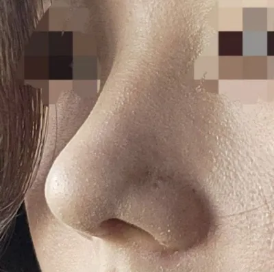 手術結果も大満足です!