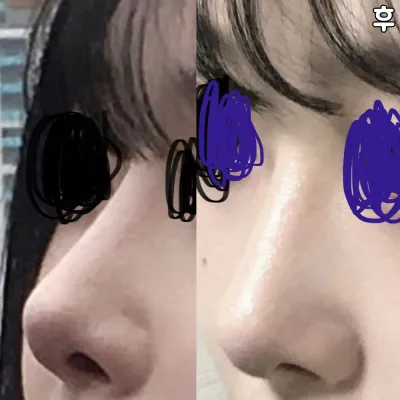 鼻がとても綺麗だとみんな言います