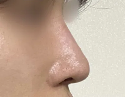 とても気に入った鼻を手に入れることができて嬉しいです!