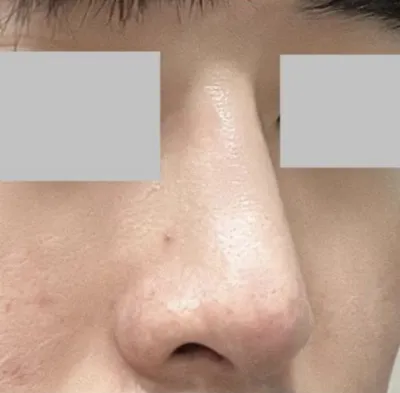 自然な仕上がりを希望していましたが、まさに私にぴったりでした