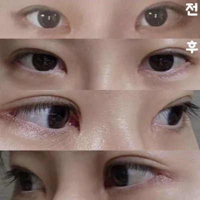 以前よりずっと重苦しさがなくなり、すっきりして見えるのでとても満足しています！