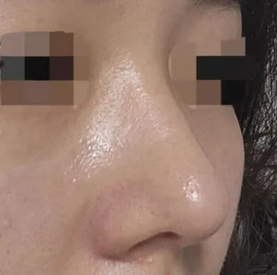 すごく悩んで決めた手術でしたが、お金がもったいなくないほどとても幸せです！