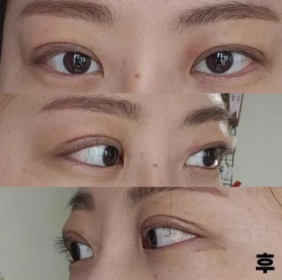 手術して本当によかったと思います