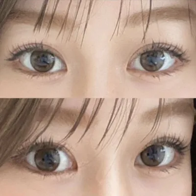 過剰診療もなく、手術後も完全によく面倒を見てくださいましたㅎㅎㅎ