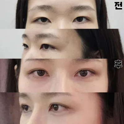 本当に薄くて自然なラインで上手く仕上げてくれます