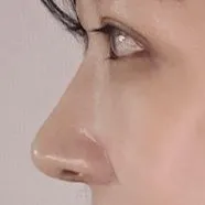 美しい目と鼻を作っていただきありがとうございます