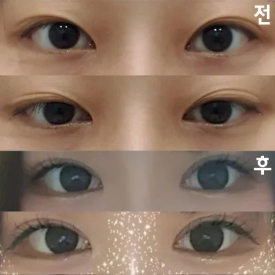 ラインもほぼ同じように仕上がって、とても満足しています！！