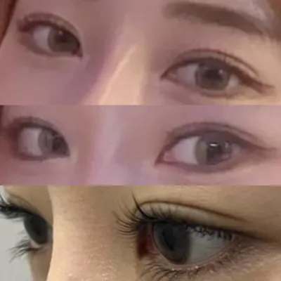 目の手術から早くも1ヶ月が過ぎました~~